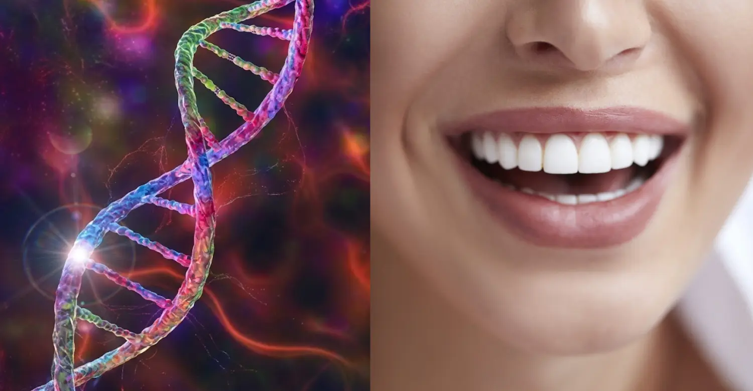 Huntington’s Disease and Oral Health 2
